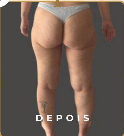 Tecnologia Clínica Leve Slim
